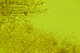 Sistotrema porulosum image