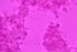 Sistotrema porulosum image