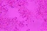 Sistotrema porulosum image
