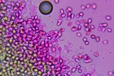 Sistotrema porulosum image