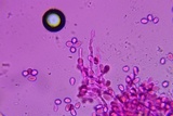 Sistotrema porulosum image