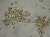 Inocybe fuscidula image