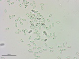 Stromatinia rapulum image
