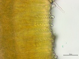 Stromatinia rapulum image