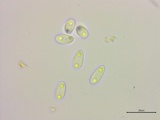 Stromatinia rapulum image