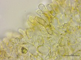 Stromatinia rapulum image