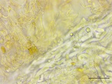 Stromatinia rapulum image