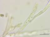 Stromatinia rapulum image