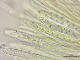 Stromatinia rapulum image