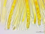 Stromatinia rapulum image
