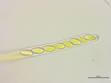 Stromatinia rapulum image