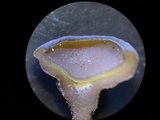 Stromatinia rapulum image