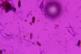 Hysterobrevium mori image