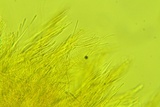 Arachnopeziza aurelia image