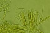 Arachnopeziza aurelia image