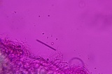 Henningsomyces candidus image