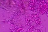 Henningsomyces candidus image