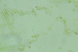 Claussenomyces olivaceus image