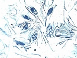 Caloplaca pyracea image