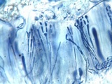 Caloplaca pyracea image