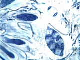 Caloplaca pyracea image