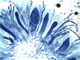Caloplaca pyracea image