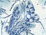 Caloplaca pyracea image