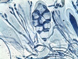 Caloplaca pyracea image