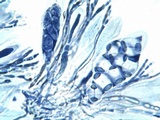 Caloplaca pyracea image