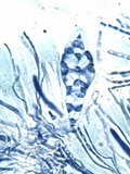 Caloplaca pyracea image