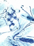 Caloplaca pyracea image