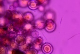 Sphaerosporium lignatile image