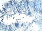Caloplaca variabilis image