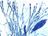 Caloplaca variabilis image