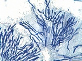 Caloplaca variabilis image