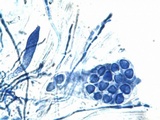 Caloplaca variabilis image