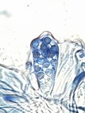 Caloplaca variabilis image
