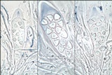 Caloplaca variabilis image