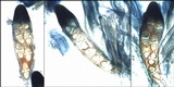 Caloplaca variabilis image