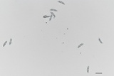 Colletotrichum trichellum image