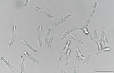 Mycosphaerella pini image