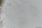 Mycosphaerella pini image