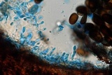 Sphaeropsis sapinea image