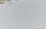 Kabatina juniperi image