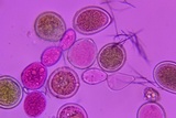 Sphaerosporium lignatile image