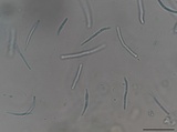 Pseudocercospora kalmiae image
