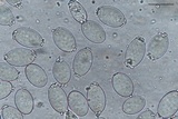 Morchella diminutiva image