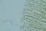 Peziza waltersii image