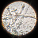 Hypomyces luteovirens image