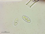 Sarcoscypha austriaca image